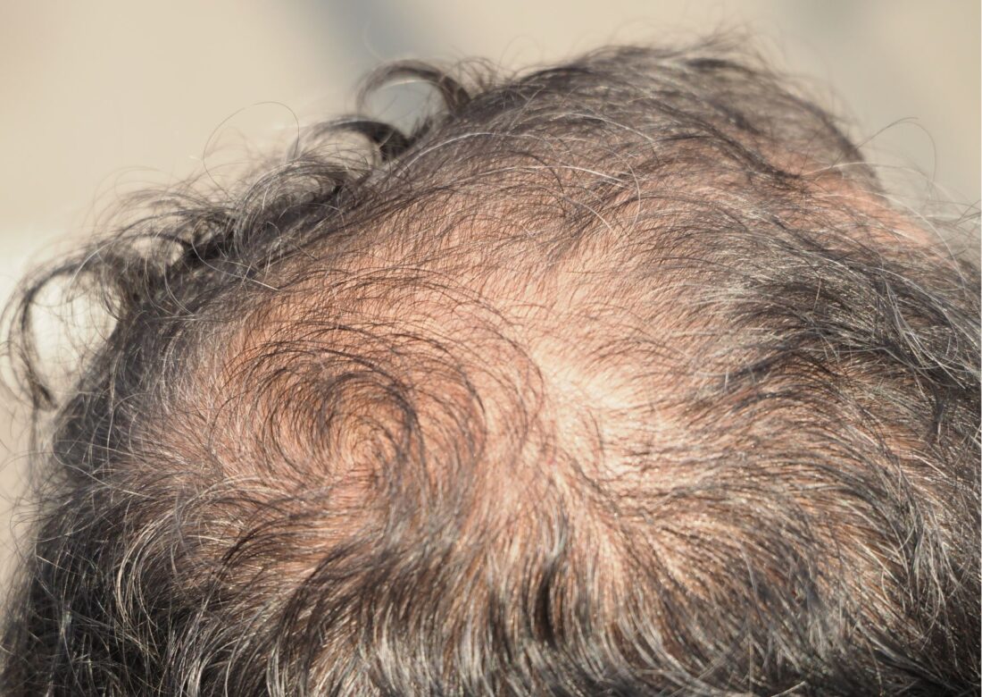 seffihair